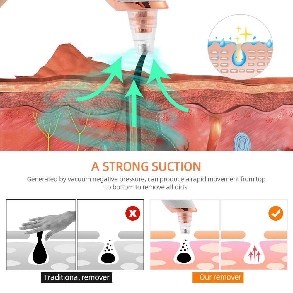 Electric Blackhead Remover Vacuum